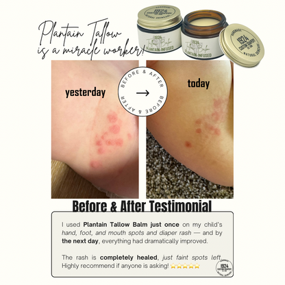 Plantain Tallow Balm