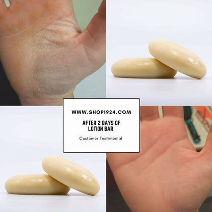 Lotion Bars